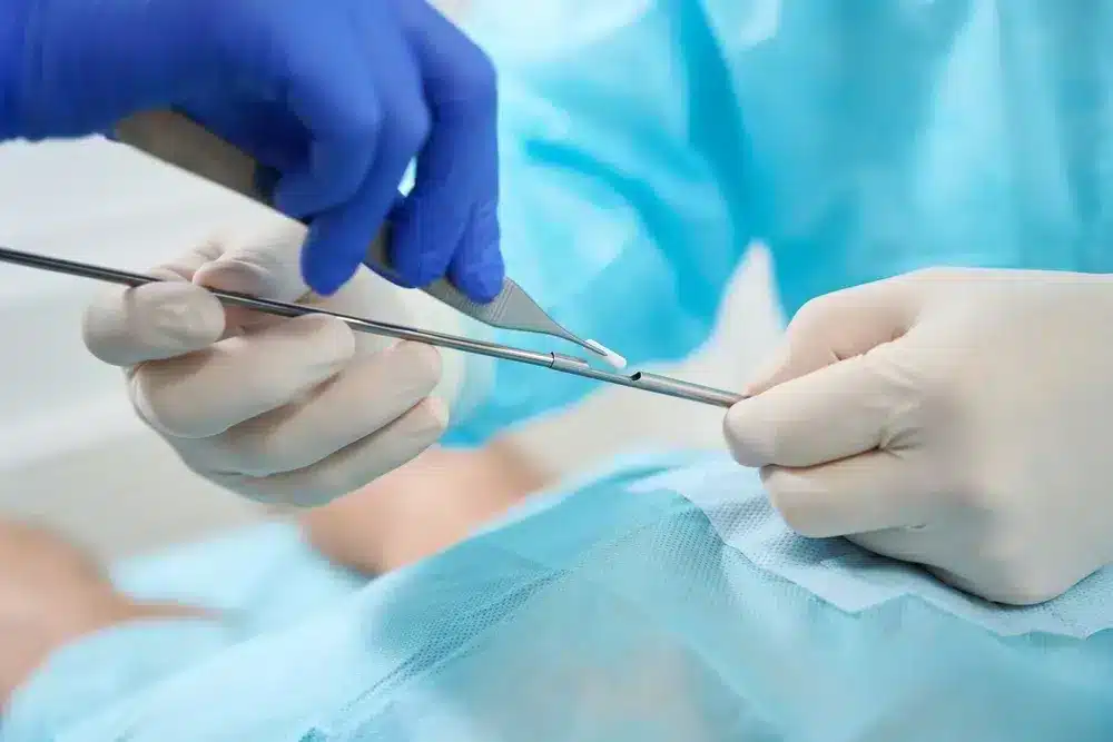 How to Get Started with Hormone Pelleting: Finding a Certified Provider
