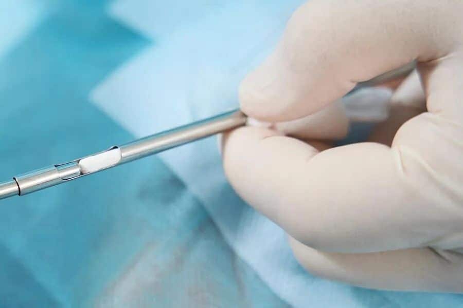 What to Expect During Your First Biote Hormone Pellet Insertion