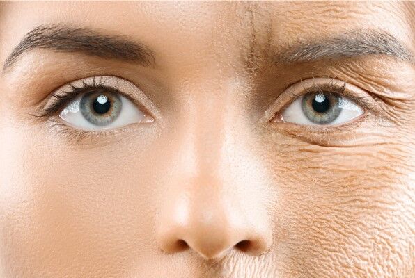 Transforming Your Skin With Secret Rf Treatment2