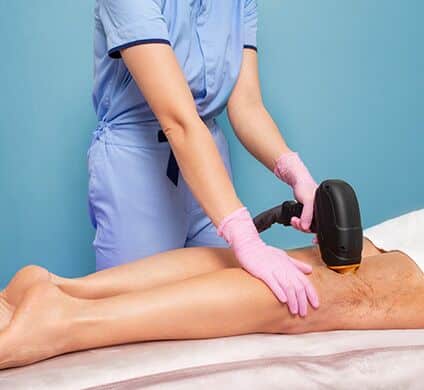 1777307450_Laser-Vein-Therapy-Varicose-and-Spider-Veins-Treatment-img Laser Vein Therapy: Varicose and Spider Veins