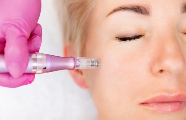 Secret RF Radiofrequency Microneedling 2