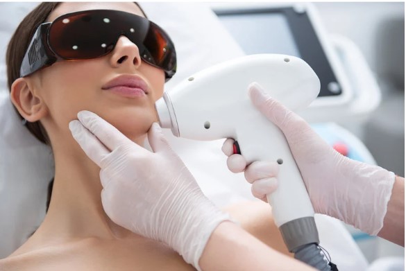 Laser Technology Work To Treat Acne